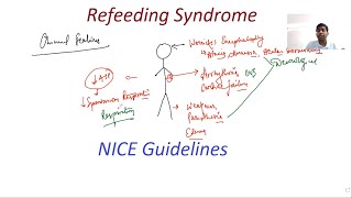 Refeeding Syndrome  NICE Guidelines  General Surgery Lectures  MRCS MS DNB [upl. by Yelir77]