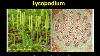 Different types of Steles found in Lycopodium [upl. by Azila885]