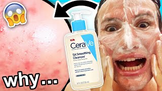 I tried CeraVe SA Cleanser for ONE WEEK I was shocked honey in tears almost [upl. by Nosnej]