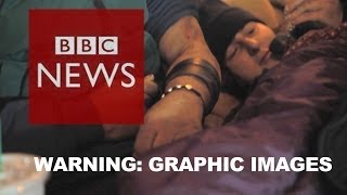 BBC goes undercover inside Americas heroin epidemic  BBC News [upl. by Cleasta]