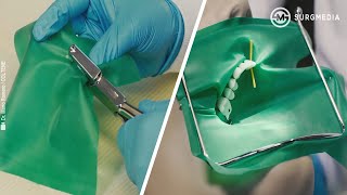 Basics of Dental Rubber Dam Placement [upl. by Aihseuqram]