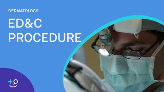 EDampC Procedure Overview Dermatology [upl. by Akeyla]