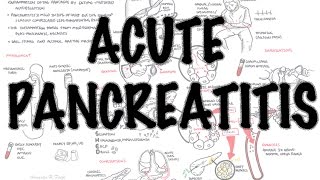 Acute Pancreatitis  Overview signs and symptoms pathophysiology investigations treatment [upl. by Narcissus]