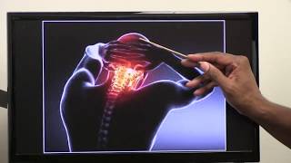 Practical osteology 2  skull  normal occipitalis  by Dr Wahdan [upl. by Seymour230]