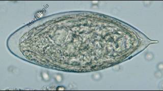 Schistosoma Haematobium [upl. by Ecirehs]