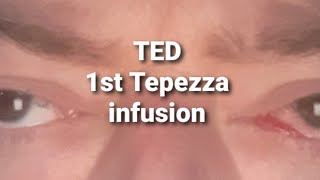 TED First Tepezza infusion [upl. by Drawoh]