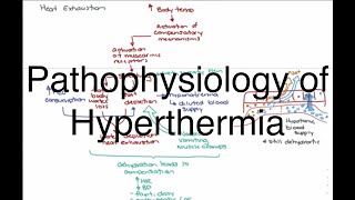 Hyperthermia Pathophysiology [upl. by Ramedlab]