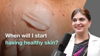 How Long Does It Take to See Healthy Skin  Cureskin [upl. by Eiluj]