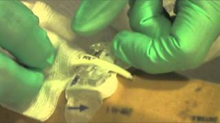 PICC line dressing change [upl. by Haleak538]