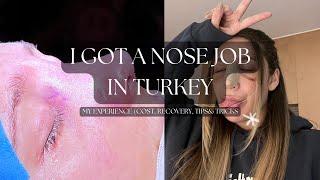 I GOT A NOSE JOB IN TURKEY My Experience [upl. by Calore817]