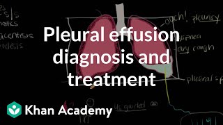 Pleural effusion diagnosis and treatment  Respiratory system diseases  NCLEXRN  Khan Academy [upl. by Getraer]