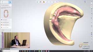 Digital Dentures A Crash Course on How to Design using 3Shape  Logan Woomer [upl. by Lennahs928]