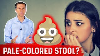 What Does PaleColored Poop Mean – DrBerg [upl. by Alpers391]