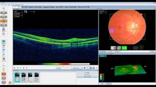 Maestro Software Tutorial [upl. by Prasad]