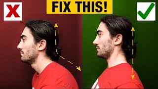 How to Fix Forward Head  Slumped Posture PERMANENTLY [upl. by Schaab14]