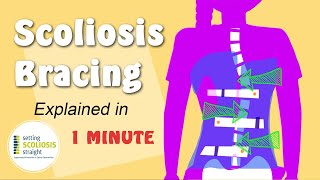 Scoliosis Brace  Explained Under 1 Minute [upl. by Tomkin]