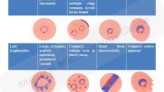 Laboratory diagnosis of Malaria lecture [upl. by Hughie]