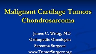 Orthopedic Oncology Course  Malignant Cartilage Tumors Chondrosarcoma  Lecture 6 [upl. by Worrell618]