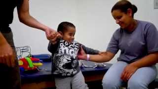 Lyndens Bilateral Clubfoot Journey [upl. by Julian]