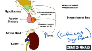 Methotrexate  Adverse Effects and Monitoring [upl. by Amund]