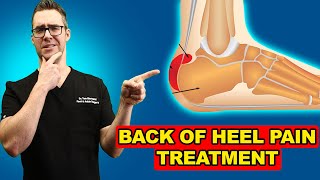 Retrocalcaneal Heel BURSITIS Treatment Heel Pain Exercises amp Massage [upl. by Bilak]