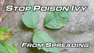 Behind the Counter Poison Ivy Facts Myths and Treatment [upl. by Lichter951]