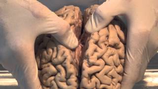 Introduction Neuroanatomy Video Lab  Brain Dissections [upl. by Sibby]