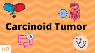 Mesenteric Adenitis vs Appendicitis  How to tell the difference [upl. by Atiuqram]