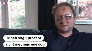 JAARWISSELING Vuurwerkslachtoffer Paul kreeg de volle laag [upl. by Anatola]