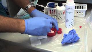 Denture Soft Reline Part 1 [upl. by Caldwell]