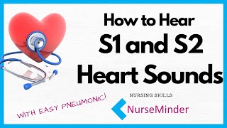 How to Hear S1 and S2 Heart Sounds [upl. by Atekin]