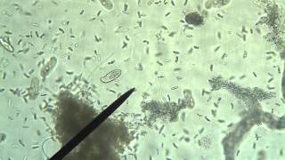 Protists Amoeba Euglena Paramecium [upl. by Nett]