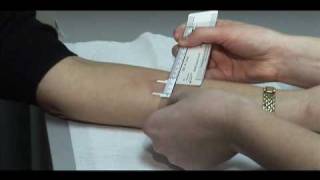 TB Skin Test  Mantoux Method [upl. by Eeramit910]