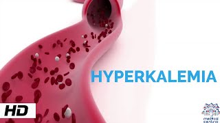 HYPERKALEMIA Causes Signs and Symptoms Diagnosis and Treatment [upl. by Elyk]