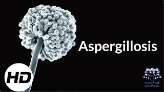 Aspergillosis Everything You Need To Know [upl. by Ylekalb]