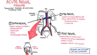 Acute Renal Failure [upl. by Nnarual]