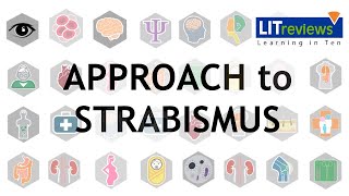 Approach to Strabismus [upl. by Adrian]