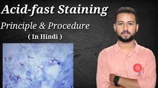 Acid fast staining procedure and principle in Hindi  Ziehl Neelsen Acid Fast staining procedure [upl. by Saalocin]