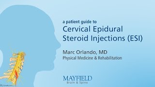 Cervical Epidural Steroid Injection [upl. by Icram]