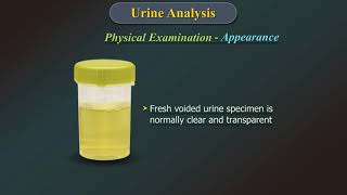 Urine Analysis [upl. by Yadnil]