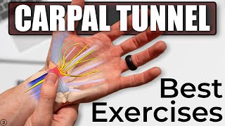 Ultrasound guided carpal tunnel syndrome injection by Murat Karkucak MD [upl. by Worra334]