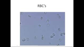 Microscopic Urinalysis [upl. by Yalcrab]