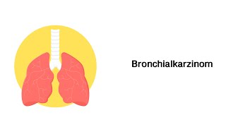 Lungenkrebs Bronchialkarzinom  Erkrankungen der Atemwege [upl. by Nauqyt918]