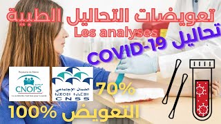 ✅ CNOPS CNSS تعويضات التحاليل الطبية [upl. by Sunil]