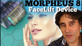 MORPHEUS 8  Non Surgical Facelift [upl. by Uird]