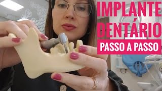 Implante Dentário Passo a Passo l Dra Danielle Sales [upl. by Shelton790]