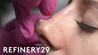 I Tried A NonSurgical Nose Job  Macro Beauty  Refinery29 [upl. by Aronoel]