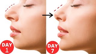 How To Get Straight  Slim and Sharper Nose Beauty Tips In Hindi [upl. by Ahsiekrats699]