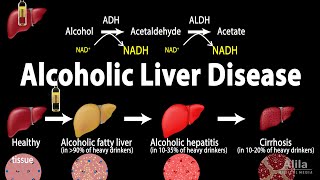 Alcoholic Liver Disease Animation [upl. by Aniroz]