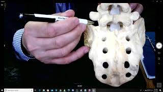 S1 pedicle screw placement tips and tricks EXTENDED [upl. by Honor]